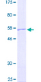 NFU1 Protein - 12.5% SDS-PAGE of human NFU1 stained with Coomassie Blue