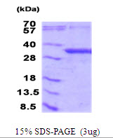 NFU1 Protein