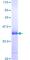 NFX1 Protein - 12.5% SDS-PAGE Stained with Coomassie Blue.