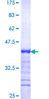 NFXL1 Protein - 12.5% SDS-PAGE Stained with Coomassie Blue.