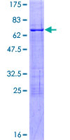 NFYA Protein - 12.5% SDS-PAGE of human NFYA stained with Coomassie Blue