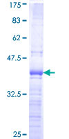 NFYA Protein - 12.5% SDS-PAGE Stained with Coomassie Blue.