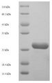 NFYB Protein - (Tris-Glycine gel) Discontinuous SDS-PAGE (reduced) with 5% enrichment gel and 15% separation gel.