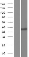 NFYC Protein - Western validation with an anti-DDK antibody * L: Control HEK293 lysate R: Over-expression lysate