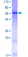 NFYC Protein - 12.5% SDS-PAGE of human NFYC stained with Coomassie Blue