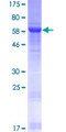 NFYC Protein - 12.5% SDS-PAGE of human NFYC stained with Coomassie Blue