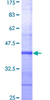 NFYC Protein - 12.5% SDS-PAGE Stained with Coomassie Blue.