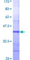 NFYC Protein - 12.5% SDS-PAGE Stained with Coomassie Blue.