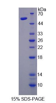 NFYC Protein - Recombinant Nuclear Transcription Factor Y Gamma By SDS-PAGE