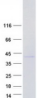 NFYC Protein - Purified recombinant protein NFYC was analyzed by SDS-PAGE gel and Coomassie Blue Staining