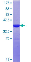 NGEF / EPHEXIN Protein - 12.5% SDS-PAGE Stained with Coomassie Blue.