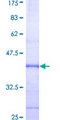 NGF Protein - 12.5% SDS-PAGE Stained with Coomassie Blue.