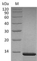 NGF Protein - (Tris-Glycine gel) Discontinuous SDS-PAGE (reduced) with 5% enrichment gel and 15% separation gel.