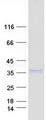 NGF Protein - Purified recombinant protein NGF was analyzed by SDS-PAGE gel and Coomassie Blue Staining