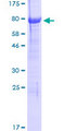 NGFR / CD271 / TNR16 Protein - 12.5% SDS-PAGE of human NGFR stained with Coomassie Blue