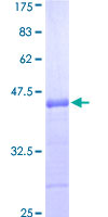 NGFR / CD271 / TNR16 Protein - 12.5% SDS-PAGE Stained with Coomassie Blue.