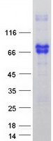 NGFR / CD271 / TNR16 Protein - Purified recombinant protein NGFR was analyzed by SDS-PAGE gel and Coomassie Blue Staining