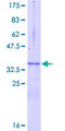 NGFRAP1 / NADE / Bex Protein - 12.5% SDS-PAGE of human NGFRAP1 stained with Coomassie Blue