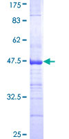 NGFRAP1 / NADE / Bex Protein - 12.5% SDS-PAGE Stained with Coomassie Blue.