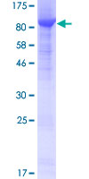 NGLY1 Protein - 12.5% SDS-PAGE of human NGLY1 stained with Coomassie Blue