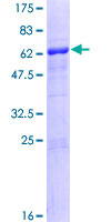 NHEJ1 / XLF Protein - 12.5% SDS-PAGE of human NHEJ1 stained with Coomassie Blue