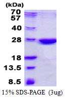 NHEJ1 / XLF Protein