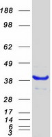 NHEJ1 / XLF Protein - Purified recombinant protein NHEJ1 was analyzed by SDS-PAGE gel and Coomassie Blue Staining