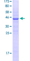 NHLH2 / HEN2 Protein - 12.5% SDS-PAGE Stained with Coomassie Blue.