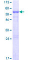 NHLRC2 Protein - 12.5% SDS-PAGE of human NHLRC2 stained with Coomassie Blue