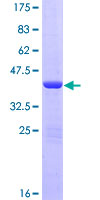 NHP2L1 Protein - 12.5% SDS-PAGE of human NHP2L1 stained with Coomassie Blue