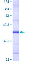 NHP2L1 Protein - 12.5% SDS-PAGE Stained with Coomassie Blue.