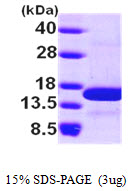 NHP2L1 Protein