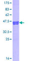NHS Protein - 12.5% SDS-PAGE Stained with Coomassie Blue.