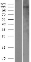 NHSL2 Protein - Western validation with an anti-DDK antibody * L: Control HEK293 lysate R: Over-expression lysate