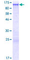 NHSL2 Protein - 12.5% SDS-PAGE of human NHSL2 stained with Coomassie Blue