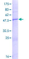NICN1 Protein - 12.5% SDS-PAGE of human NICN1 stained with Coomassie Blue