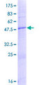 NICN1 Protein - 12.5% SDS-PAGE of human NICN1 stained with Coomassie Blue