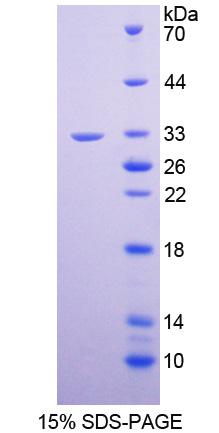 NID1 / Entactin / Nidogen-1 Protein - Recombinant  Nidogen By SDS-PAGE
