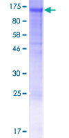 NID2 / Nidogen-2 Protein - 12.5% SDS-PAGE of human NID2 stained with Coomassie Blue