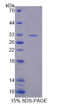 NID2 / Nidogen-2 Protein - Recombinant  Nidogen 2 By SDS-PAGE