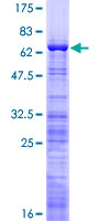 NIFK / MKI67IP Protein - 12.5% SDS-PAGE of human MKI67IP stained with Coomassie Blue