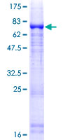 NIM1K / NIM1 Protein - 12.5% SDS-PAGE of human MGC42105 stained with Coomassie Blue