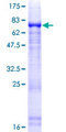 NIM1K / NIM1 Protein - 12.5% SDS-PAGE of human MGC42105 stained with Coomassie Blue