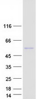 NIM1K / NIM1 Protein - Purified recombinant protein NIM1K was analyzed by SDS-PAGE gel and Coomassie Blue Staining