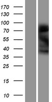 NINJ1 / Ninjurin Protein - Western validation with an anti-DDK antibody * L: Control HEK293 lysate R: Over-expression lysate