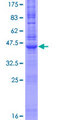 NINJ1 / Ninjurin Protein - 12.5% SDS-PAGE of human NINJ1 stained with Coomassie Blue