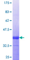 NINJ1 / Ninjurin Protein - 12.5% SDS-PAGE Stained with Coomassie Blue.