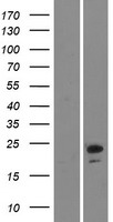 NINJ2 / Ninjurin 2 Protein - Western validation with an anti-DDK antibody * L: Control HEK293 lysate R: Over-expression lysate