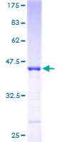 NINJ2 / Ninjurin 2 Protein - 12.5% SDS-PAGE of human NINJ2 stained with Coomassie Blue