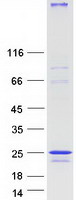 NINJ2 / Ninjurin 2 Protein - Purified recombinant protein NINJ2 was analyzed by SDS-PAGE gel and Coomassie Blue Staining